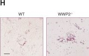Fig.5.H showing Immunohistochemistry from the publication: WWP2 Regulates Renal Fibrosis and the Metabolic Reprogramming of Profibrotic Myofibroblasts.
