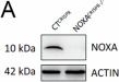 Fig.1.A showing Western Blotting in a Homo sapiens (Human) sample from the publication: NOXA/MCL-1 axis determines cell-death decision between apoptosis and a GSDME-dependent cell death associated with production of inflammatory cytokines upon treatment of breast cancer cells with antimitotics.