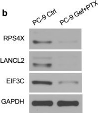 Fig.2.B showing Western Blotting from the publication: Akt kinase LANCL2 functions as a key driver in EGFR-mutant lung adenocarcinoma tumorigenesis.