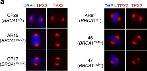 Fig.2.A showing Immunocytochemistry-immunofluorescence in a Homo sapiens (Human) sample from the publication: BRCA1 haploinsufficiency for replication stress suppression in primary cells.