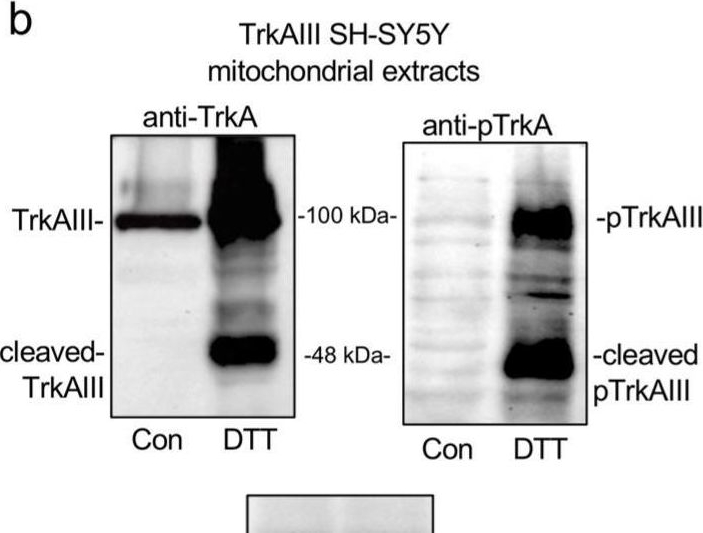 Fig.1.B showing Western Blotting in a Homo sapiens (Human) sample from the publication: Molecular Characterization and Inhibition of a Novel Stress-Induced Mitochondrial Protecting Role for Misfolded TrkAIII in Human SH-SY5Y Neuroblastoma Cells.