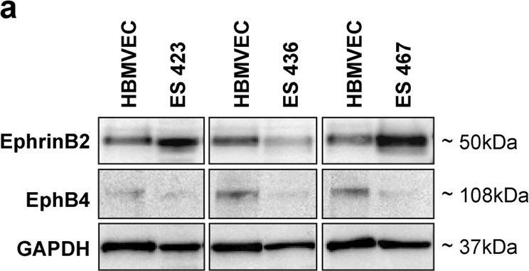 Fig.2.A showing Western Blotting in a Homo sapiens (Human) sample from the publication: Dysregulation of the EphrinB2-EphB4 ratio in pediatric cerebral arteriovenous malformations is associated with endothelial cell dysfunction in vitro and functions as a novel noninvasive biomarker in patients.