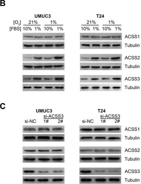 Fig.2.B,C showing Western Blotting in a Homo sapiens (Human) sample from the publication: Acetyl-CoA synthetase 3 promotes bladder cancer cell growth under metabolic stress.