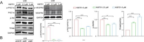 Phospho-Akt (Thr308) (244F9) Rabbit mAb | Cell Signaling