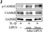 Fig.3.J showing Western Blotting in a Mus musculus (House mouse) sample from the publication: LIPUS Promotes Calcium Oscillation and Enhances Calcium Dependent Autophagy of Chondrocytes to Alleviate Osteoarthritis.