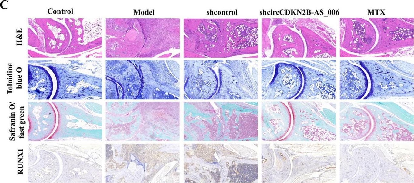 Fig.8.C showing Immunohistochemistry in a Mus musculus (House mouse) sample from the publication: Circular RNA CircCDKN2B-AS_006 Promotes the Tumor-like Growth and Metastasis of Rheumatoid Arthritis Synovial Fibroblasts by Targeting the miR-1258/RUNX1 Axis.