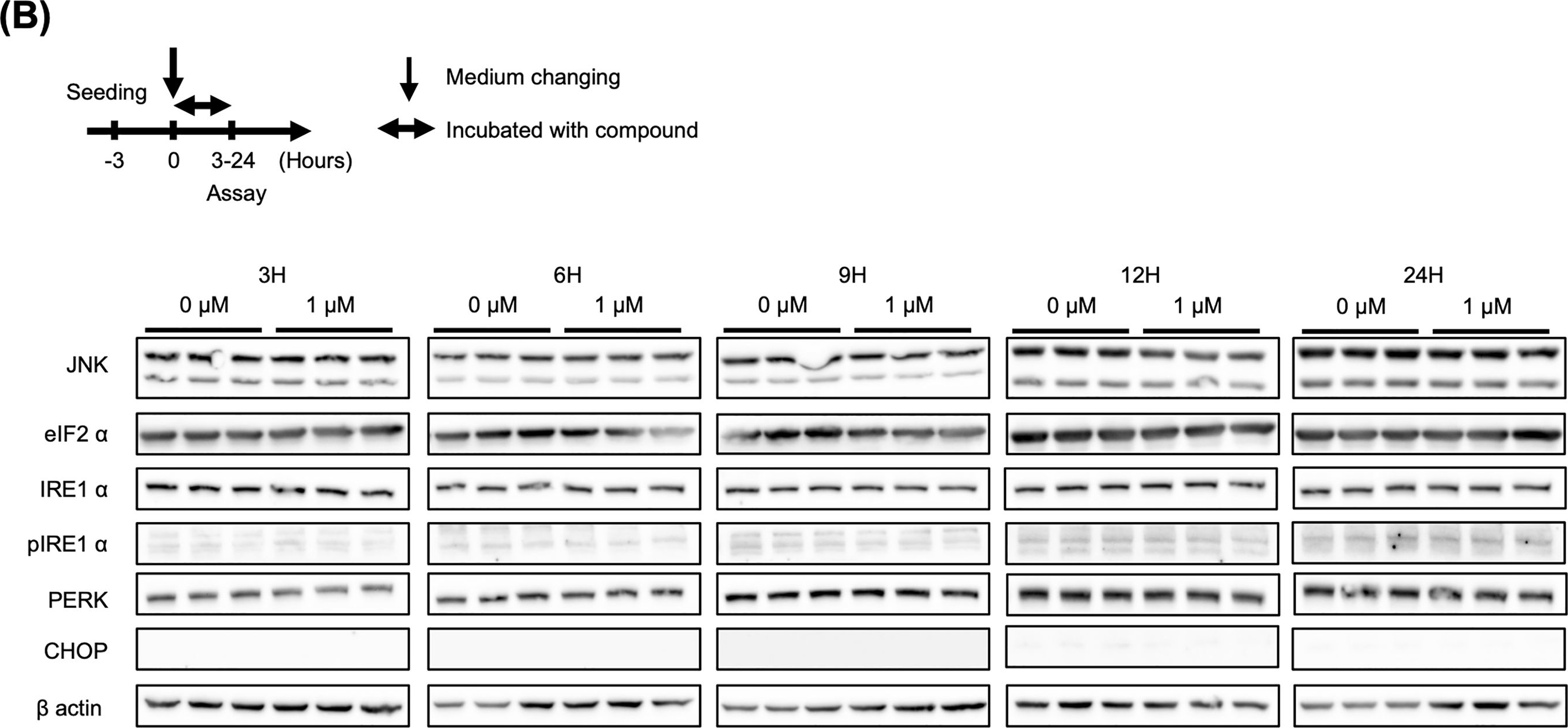 Fig.3.B showing Western Blotting from the publication: Auranofin, identified by FDA-approved drug library screening, inhibits HBs antigen secretion via lysosomal damage.