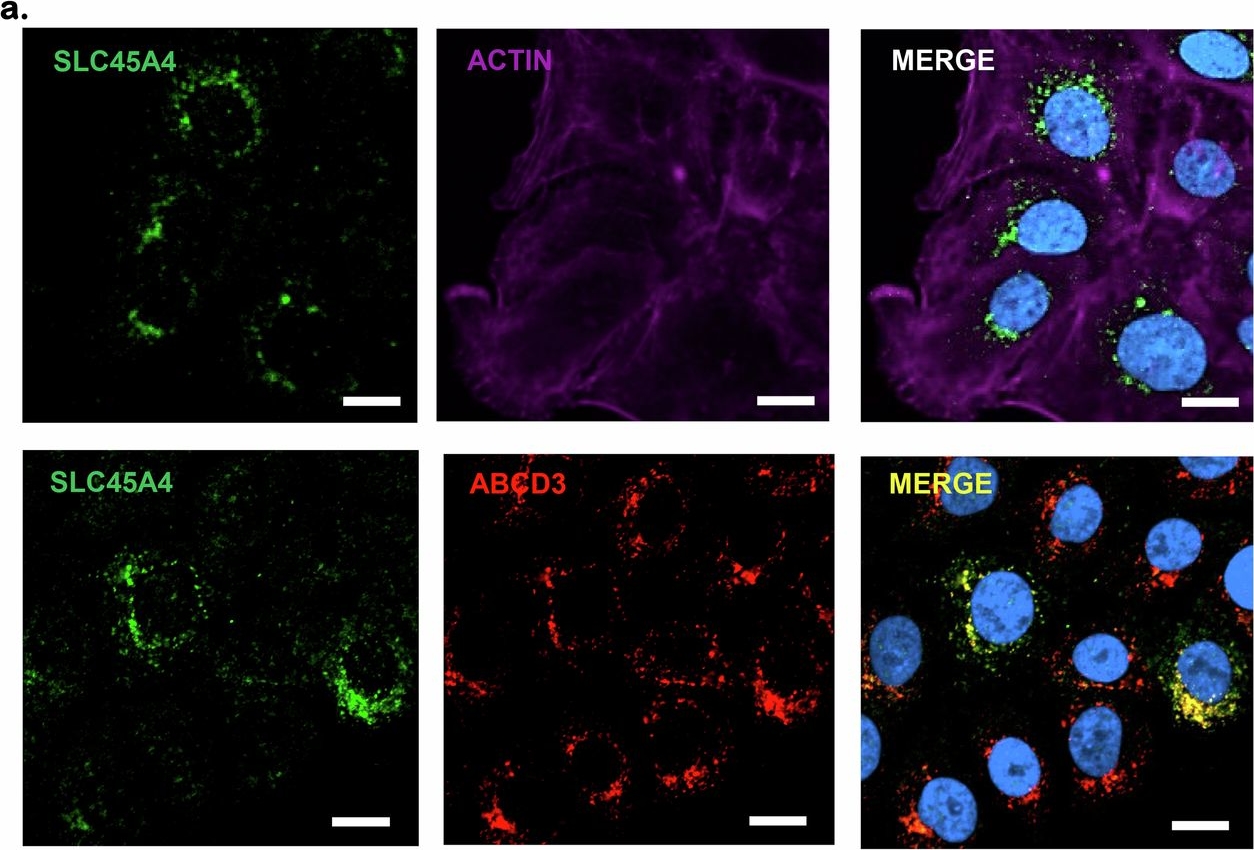 Fig.5.A showing Immunocytochemistry-immunofluorescence from the publication: SLC45A4 encodes a peroxisomal putrescine transporter that promotes GABA de novo synthesis.
