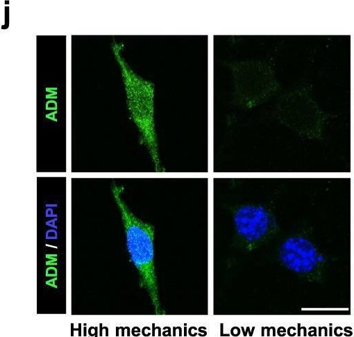 Fig.4.J showing Immunocytochemistry-immunofluorescence from the publication: The role of mechano-regulated YAP/TAZ in erectile dysfunction.
