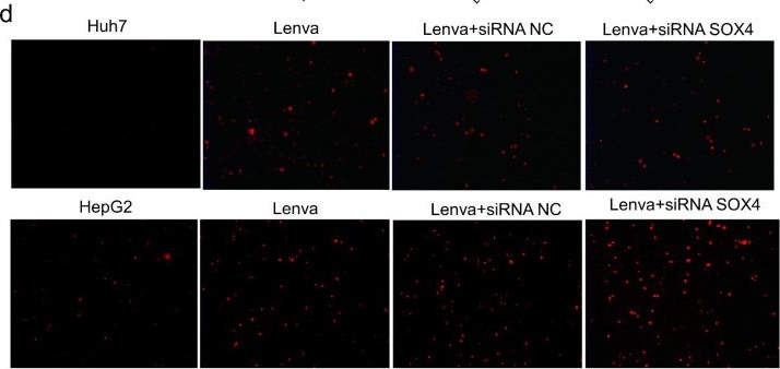 Fig.7.D showing Immunocytochemistry-immunofluorescence in a Homo sapiens (Human) sample from the publication: Pan-Cancer Analysis and Experimental Validation of SOX4 as a Potential Diagnosis, Prognosis, and Immunotherapy Biomarker.