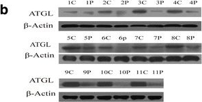 Fig.1.B showing Western Blotting in a Homo sapiens (Human) sample from the publication: Long non-coding RNA NEAT1-modulated abnormal lipolysis via ATGL drives hepatocellular carcinoma proliferation.