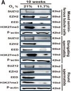 Fig.3.A showing Western Blotting from the publication: Chronic Hypoxia Disrupts Spermatogenesis Through ASXL2-EZH2-Mediated Microtubule Destabilization.