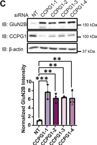 Fig.3.C showing Western Blotting from the publication: A GluN2B disease-associated variant promotes the degradation of NMDA receptors via autophagy.