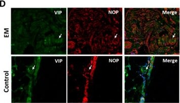 Fig.2.D showing Immunohistochemistry-immunofluorescence in a Homo sapiens (Human) sample from the publication: Nociceptin/Orphanin FQ Opioid Peptide-Receptor Expression in the Endometriosis-Associated Nerve Fibers-Possible Treatment Option?