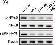 Fig.5.C showing Western Blotting in a Homo sapiens (Human) sample from the publication: Melatonin supplementation protects against traumatic colon injury by regulating SERPINA3N protein expression.