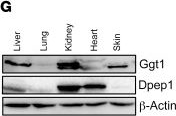 Fig.6.G showing Western Blotting from the publication: Circulating succinate-modifying metabolites accurately classify and reflect the status of fumarate hydratase-deficient renal cell carcinoma.