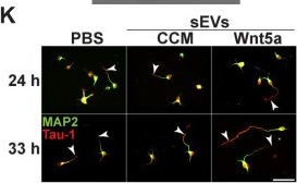 Fig.6.K showing Immunocytochemistry-immunofluorescence from the publication: Wnt5a Promotes Axon Elongation in Coordination with the Wnt-Planar Cell Polarity Pathway.