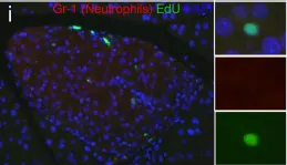 Fig.9.I showing Western Blotting in a Mus musculus (House mouse) sample from the publication: Resolving Discrepant Findings on ANGPTL8 in β-Cell Proliferation: A Collaborative Approach to Resolving the Betatrophin Controversy.