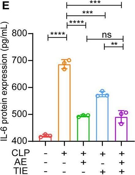 Fig.2.E showing Enzyme-linked immunosorbent assay in a Mus musculus (House mouse) sample from the publication: Aloe-emodin plus TIENAM ameliorate cecal ligation and puncture-induced sepsis in mice by attenuating inflammation and modulating microbiota.