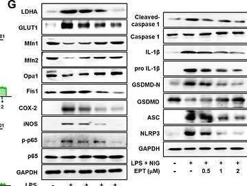 Fig.3.G showing Western Blotting from the publication: Uhrf1-Mediated PKM2 Degradation via Ubiquitination Alleviates Inflammation and Pyroptosis in Inflammatory Bowel Disease.