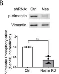 Fig.3.B showing Western Blotting from the publication: Nestin Modulates Airway Smooth Muscle Cell Migration by Affecting Spatial Rearrangement of Vimentin Network and Focal Adhesion Assembly.