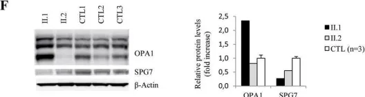 Fig.1.F showing Western Blotting from the publication: A deep intronic splice variant advises reexamination of presumably dominant SPG7 Cases.