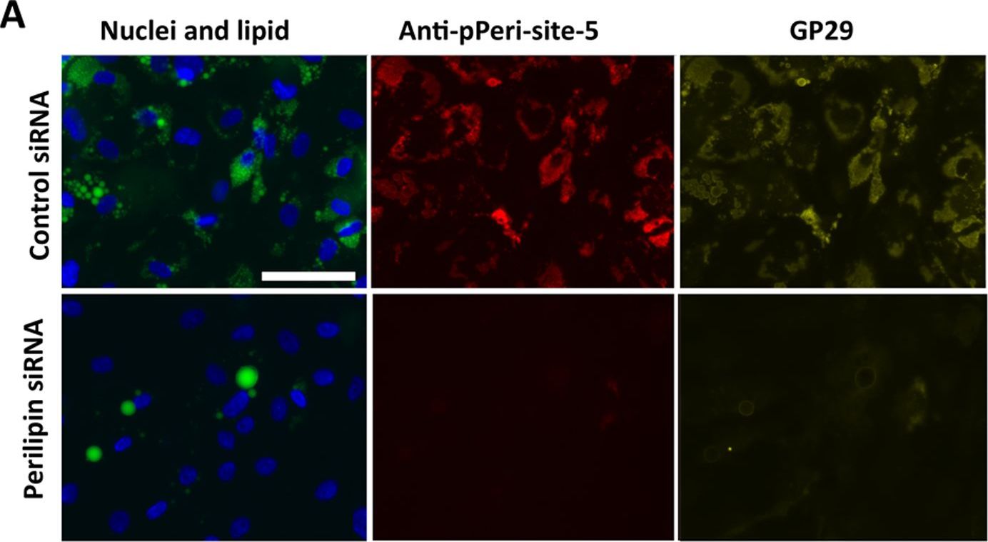 Differential phosphorylation of perilipin 1A at the initiation of lipolysis revealed by novel monoclonal antibodies and high content analysis.