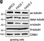 Fig.4.G showing Western Blotting from the publication: Centrosome and ciliary abnormalities in fetal akinesia deformation sequence human fibroblasts.