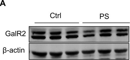 Fig.2.A showing Western Blotting in a Homo sapiens (Human) sample from the publication: Disruption of a GalR2-mitochondrial axis in the ventral hippocampus contributes to depression-like phenotypes after prenatal stress.