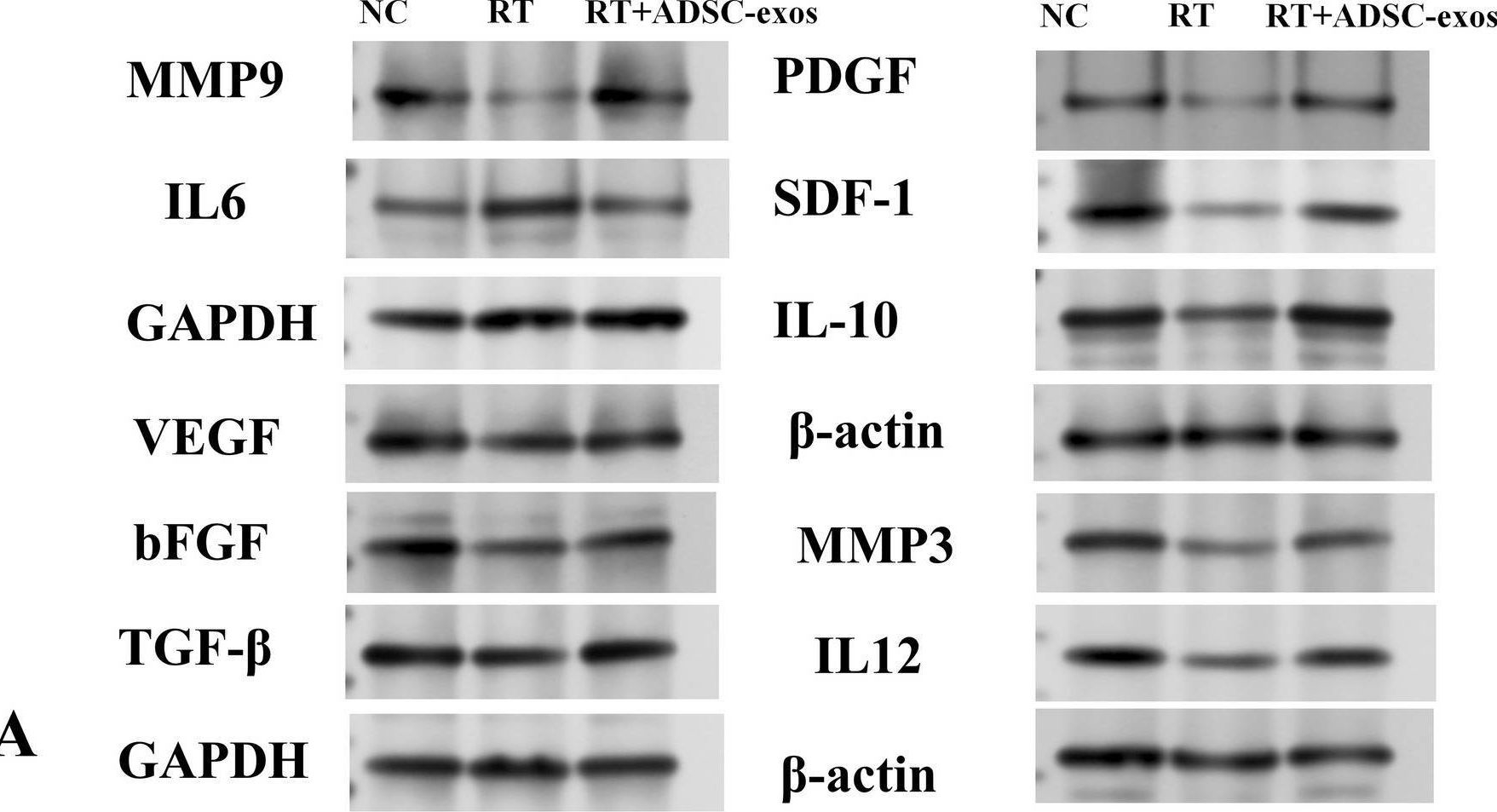 Fig.9.A showing Western Blotting in a Rattus norvegicus (Rat) sample from the publication: Exosomes derived from adipose-derived stem cells alleviate acute radiation-induced dermatitis through up-regulating hyaluronic acid synthase 1 expression.