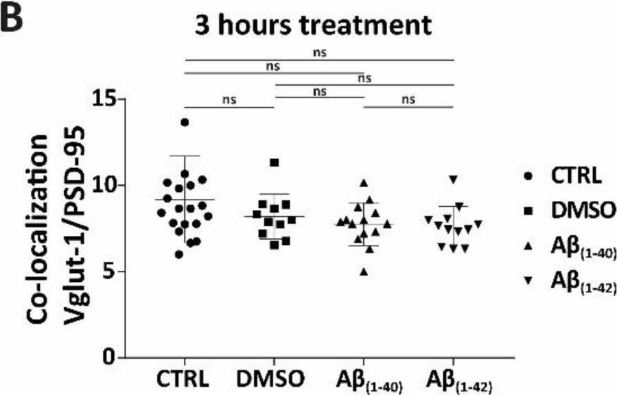 Fig.1.B from the publication: Aβ-Induced Alterations in Membrane Lipids Occur before Synaptic Loss Appears.