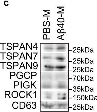 Fig.3.C showing Western Blotting from the publication: Macrophage lineage cells-derived migrasomes activate complement-dependent blood-brain barrier damage in cerebral amyloid angiopathy mouse model.