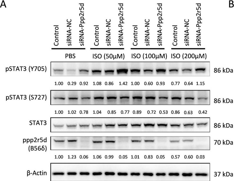 Fig.5.A showing Western Blotting from the publication: Unmasking Protein Phosphatase 2A Regulatory Subunit B as a Crucial Factor in the Progression of Dilated Cardiomyopathy.