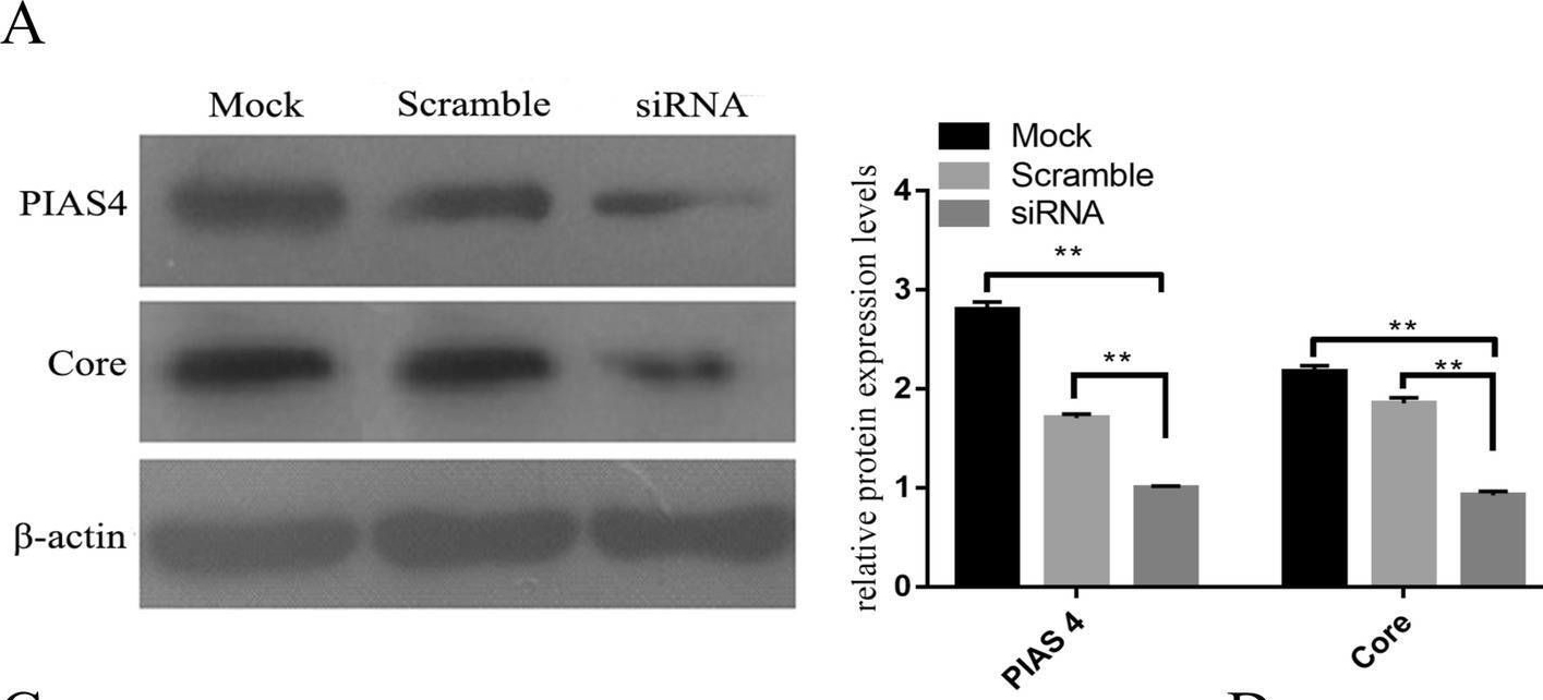 Fig.4.A showing Western Blotting in a Homo sapiens (Human) sample from the publication: Identification of protein inhibitor of activated STAT 4, a novel host interacting partner that involved in bovine viral diarrhea virus growth.
