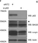 Fig.4.E showing Western Blotting from the publication: BAG5 Promotes Alpha-Synuclein Oligomer Formation and Functionally Interacts With the Autophagy Adaptor Protein p62.