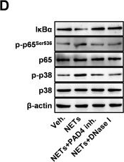 Fig.5.D showing Western Blotting from the publication: Mechanistic and functional characterization of NETs/IL-17 as a therapeutic target in EMT and brain metastasis of lung adenocarcinoma.