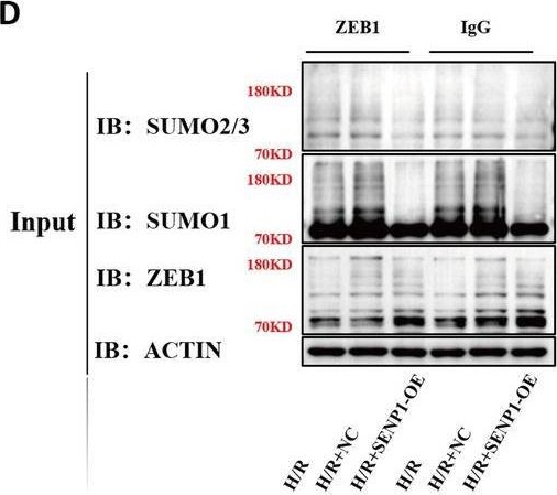 Fig.5.D showing Western Blotting from the publication: SUMOylation of ZEB1 Modulates PANoptosis in Burn-Induced Early Acute Kidney Injury.