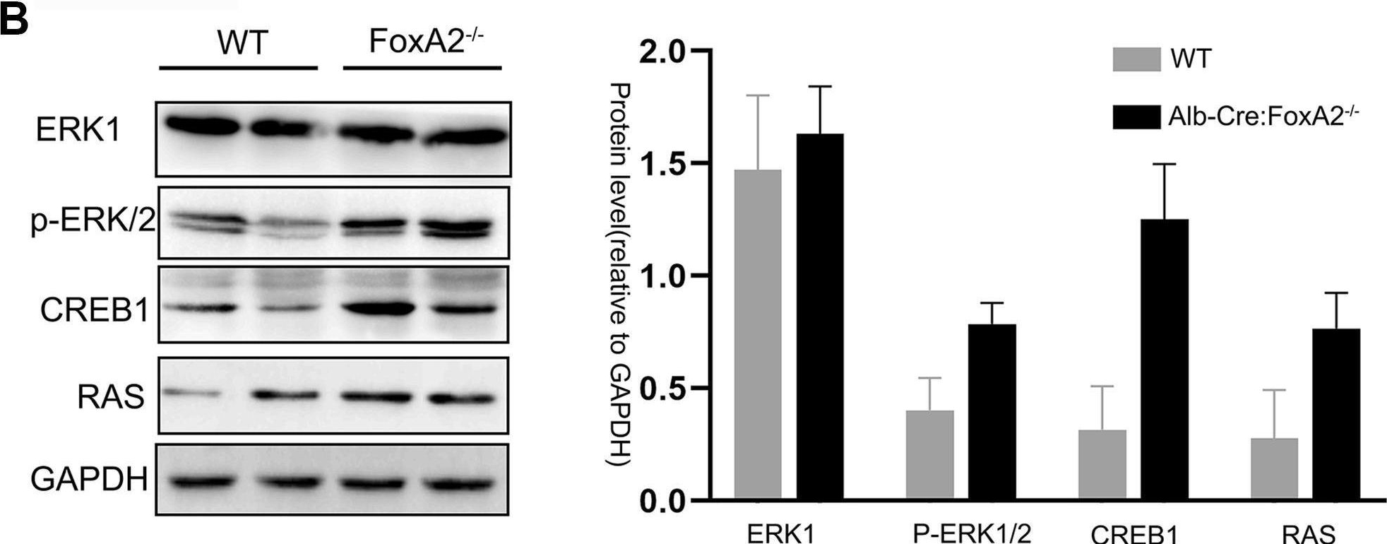 Fig.4.B showing Western Blotting from the publication: Loss of FoxA2 accelerates neoplastic changes in the intrahepatic bile duct partly via the MAPK signaling pathway.