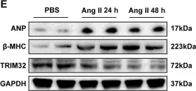 Fig.1.E showing Western Blotting in a Mus musculus (House mouse) sample from the publication: Tripartite motif 32 prevents pathological cardiac hypertrophy.