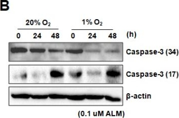 Fig.3.B showing Western Blotting in a Homo sapiens (Human) sample from the publication: 2-Oxonanonoidal Antibiotic Actinolactomycin Inhibits Cancer Progression by Suppressing HIF-1α.