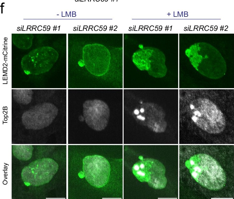 Fig.7.F showing Immunocytochemistry-immunofluorescence in a Homo sapiens (Human) sample from the publication: LRRC59 cooperates with nuclear transporters to restrain the nuclear envelope repair machinery and safeguard genome integrity.