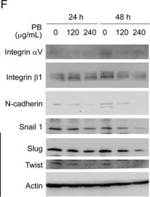 Fig.5.F showing Western Blotting in a Homo sapiens (Human) sample from the publication: Aqueous extract of Polygonum bistorta modulates proteostasis by ROS-induced ER stress in human hepatoma cells.