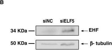 Fig.6.B showing Western Blotting in a Homo sapiens (Human) sample from the publication: Coordinate regulation of ELF5 and EHF at the chr11p13 CF modifier region.