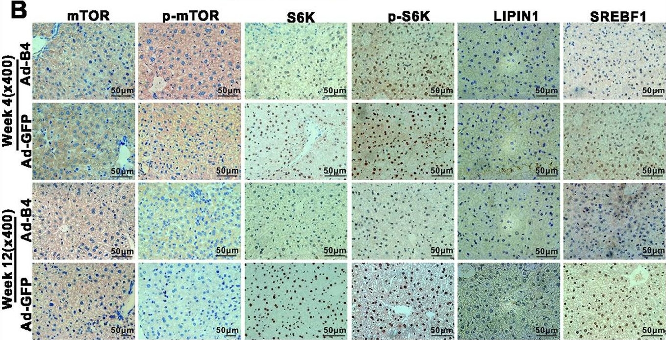 Fig.5.B showing Immunohistochemistry from the publication: Bone morphogenetic protein 4 (BMP4) alleviates hepatic steatosis by increasing hepatic lipid turnover and inhibiting the mTORC1 signaling axis in hepatocytes.