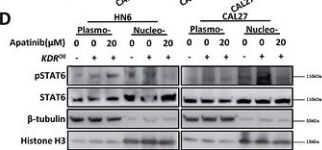Phospho-Stat6 (Tyr641) (D8S9Y) Rabbit Monoclonal Antibody | Cell