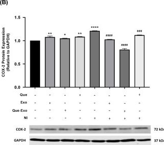 Fig.6.B showing Western Blotting in a Homo sapiens (Human) sample from the publication: Quercetin-loaded exosomes derived from human umbilical cord mesenchymal stem cells alleviate microglia-mediated neuroinflammation via an anti-inflammatory mechanism.