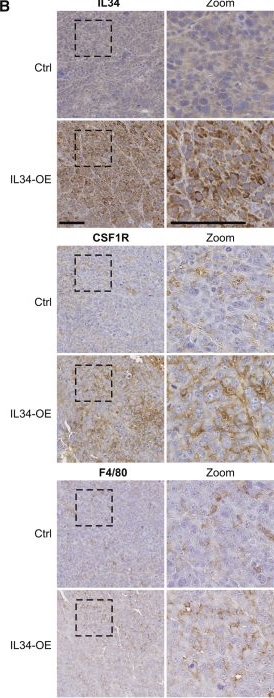 Fig.3.B showing Immunohistochemistry from the publication: Targeting the IL34-CSF1R axis improves metastatic renal cell carcinoma therapy outcome via immune-vascular crosstalk regulation.