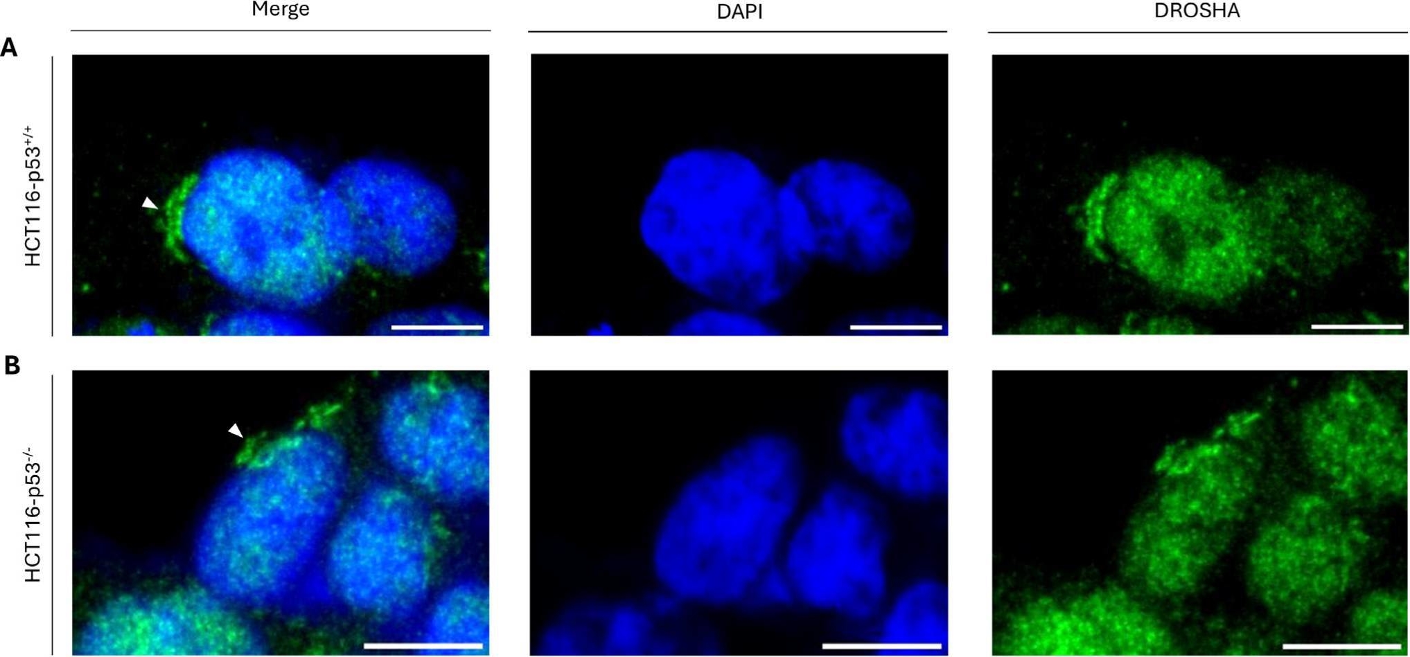 Fig.5.A showing Immunocytochemistry-immunofluorescence in a Homo sapiens (Human) sample from the publication: Non-Canonical Compartmentalization of DROSHA Protein at the Golgi Apparatus: miRNA Biogenesis-Independent Functionality in Human Cancer Cells of Diverse Tissue Origin.