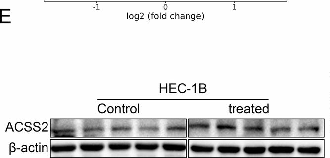 Fig.4.E showing Western Blotting in a Mus musculus (House mouse) sample from the publication: Polystyrene nanoparticles promote endometrial cancer development through the ACSS2-mediated reprogramming of arachidonic acid metabolism.