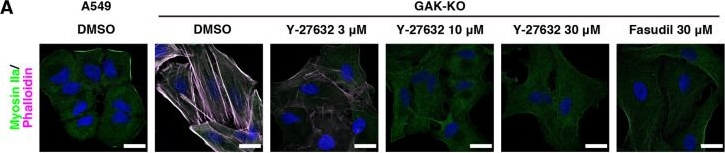 Fig.4.A showing Immunohistochemistry-immunofluorescence from the publication: GAK antagonises ROCK-dependent regulation of actomyosin dynamics.